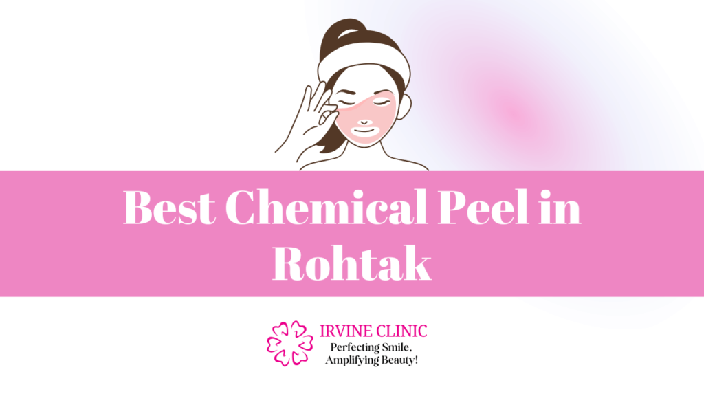 Chemical Peel in Rohtak