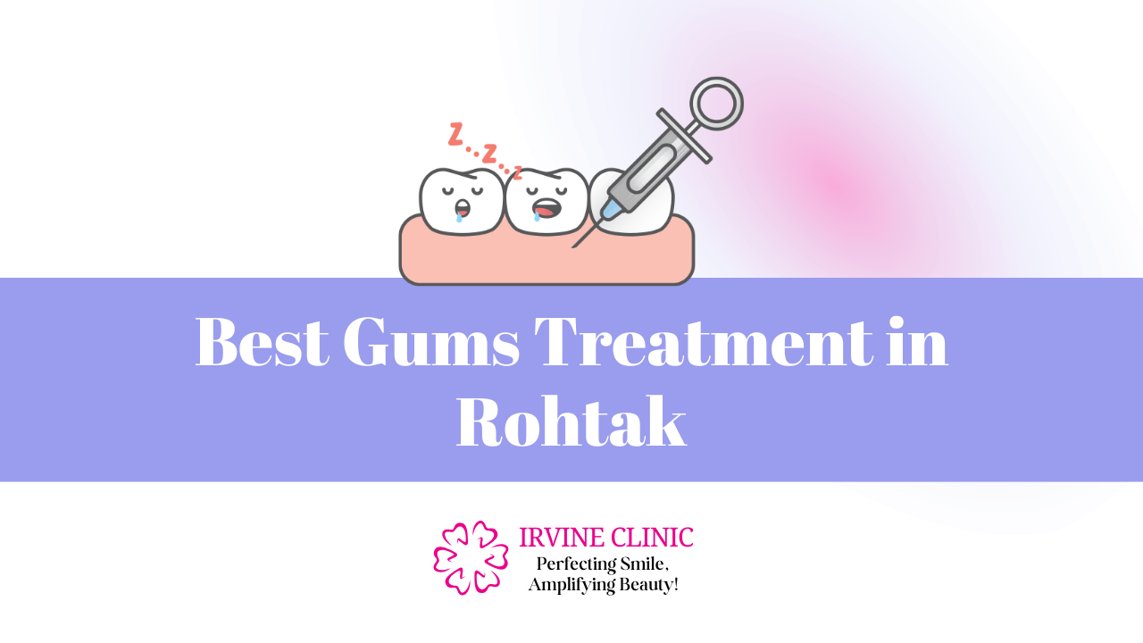 Gums Treatment in Rohtak