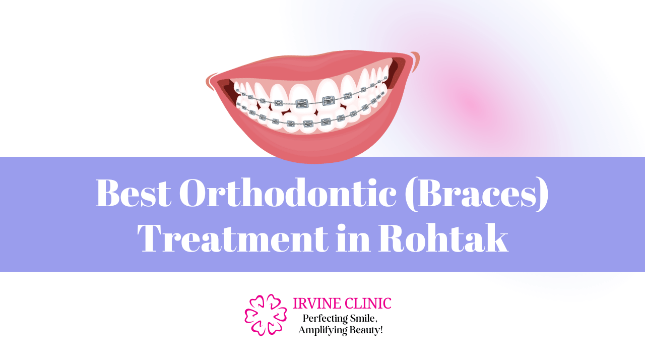 Orthodontic (Braces) Treatment